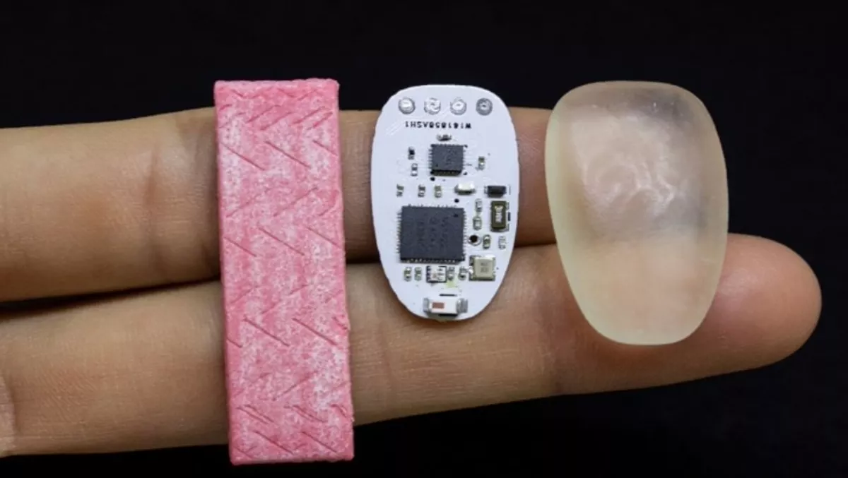 Phone ringing? This biohack wants you to bite down and ChewIt